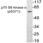 p-p70 S6K (S371) pAb?