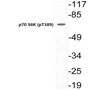 p-p70 S6K (T389) pAb?