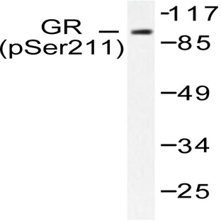 p-GR (S211) pAb