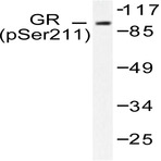 p-GR (S211) pAb