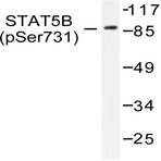 p-Stat5 (S726/731) pAb