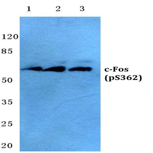 p-c-Fos (S362) pAb