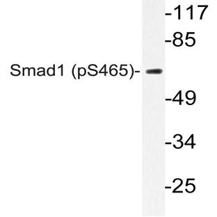 p-Smad1 (S465) pAb