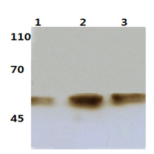 p-IkB-(beta) (T19) pAb