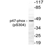 p-p47-phox (S304) pAb