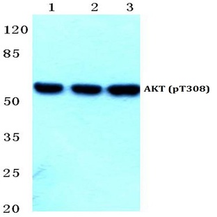 p-AKT (T308) pAb