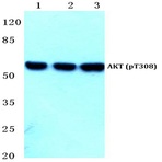 p-AKT (T308) pAb