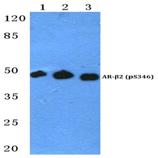 p-AR-(beta)2 (S346) pAb