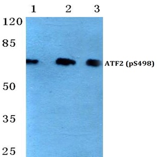 p-ATF2 (S498) pAb