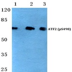 p-ATF2 (S498) pAb