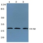 p-Casein Kinase II(beta) (S209) pAb