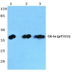 p-Casein Kinase I(alpha) (T321) pAb