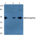 p-Cytokeratin 18 (S52) pAb