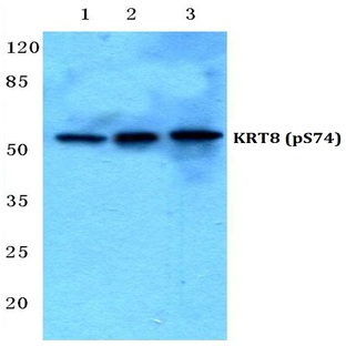 p-Cytokeratin 8 (S74) pAb