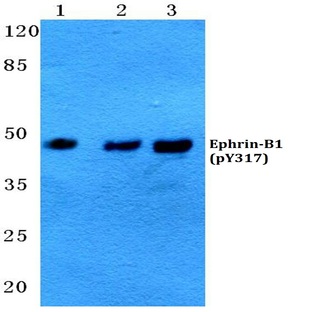 p-Ephrin-B1 (Y317) pAb