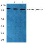 p-IFN-(gamma)R(alpha) (Y457) pAb