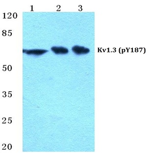 p-Kv1.3 (Y187) pAb