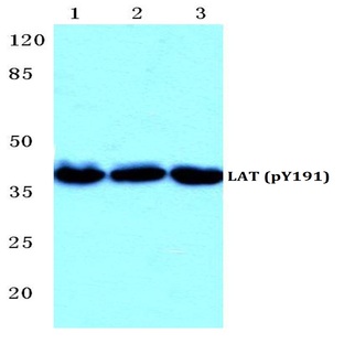 p-LAT (Y191) pAb