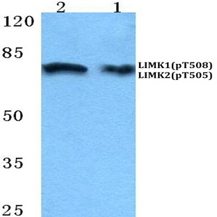 p-LIMK1/2 (T508/505) pAb