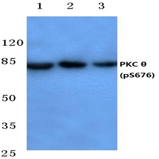 p-PKC 0 (S676) pAb