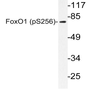 p-FKHR/FoxO1 (S256) pAb