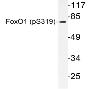 p-FKHR/FoxO1 (S319) pAb