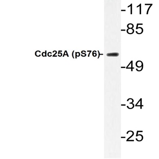 p-Cdc25A (S76) pAb