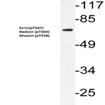  p-Ezrin(T567)/Radixin(T564)/Moesin(T558) pAb