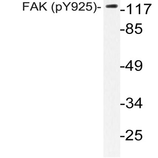 p-FAK (Y925) pAb