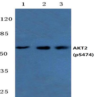 p-AKT2 (S474) pAb