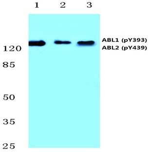 p-ABL1/2 (Y393/439) pAb