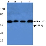 p-NFkB-p65 (S529) pAb