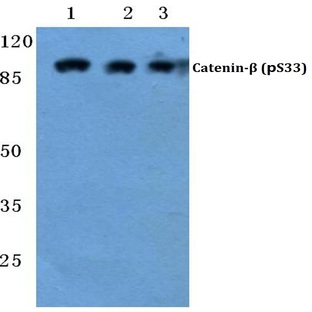 p-Catenin-(beta) (S33) pAb