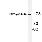 p-EGFR (Y1148) pAb