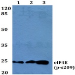 p-eIF4E (S209) pAb