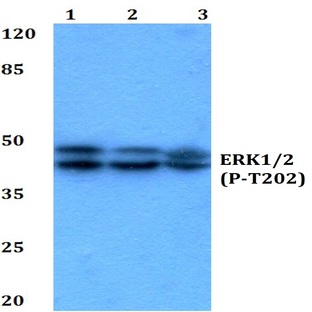 p-ERK 1/2 (T202) pAb