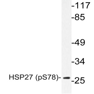 p-HSP27 (S78) pAb