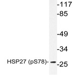 p-HSP27 (S78) pAb