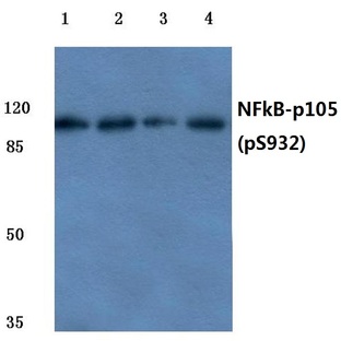 p-NFkB-p105 (S932) pAb