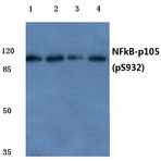 p-NFkB-p105 (S932) pAb