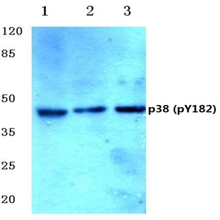 p-p38 (Y182) pAb