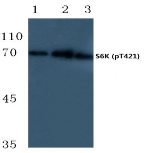 p-p70 S6K (T421) pAb