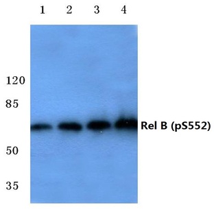 p-Rel B (S552) pAb