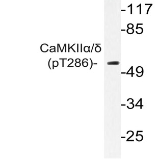 p-CaMKII(alpha)/(delta) (T286) pAb