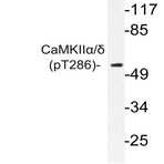 p-CaMKII(alpha)/(delta) (T286) pAb