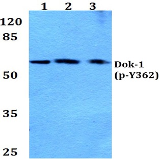 p-Dok-1 (Y362) pAb