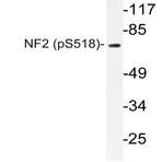 p-NF2/Merlin (S518) pAb