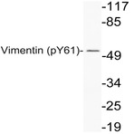 p-Vimentin (Y61) pAb