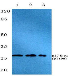 p-p27 Kip1 (T198) pAb