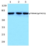 p-p70 S6K (T421) pAb